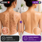 2-in-1 Body Bath Scrubber Belt | Deep Exfoliating Back Cleaner | (Body Back Scrubber Free)